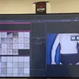 Harta alunițe în Timișoara: monitorizarea alunițelor cu platforma de videodermatoscopie FotoFinder
