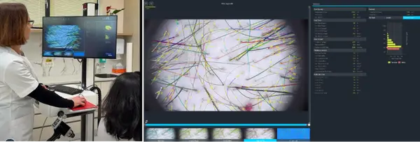 Căderea părului: diagnostic corect și tratament personalizat la dermatolog by Centrul Medical Dr. Mihălceanu
