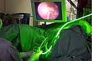 Operatia cu Laser verde pentru prostata