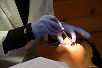 Tipuri de implanturi dentare: cum îl alegi pe cel potrivit?